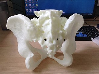 3d打印医疗骨骼