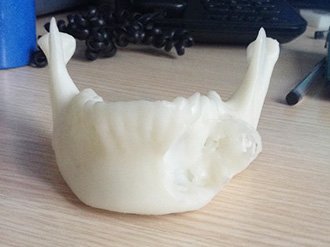 3d打印医疗骨骼牙齿
